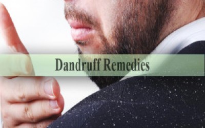 Dandruff Remedies 2